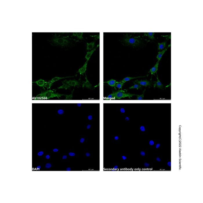 Recombinant Ezrin Antibody -    by Aladdin Scientific