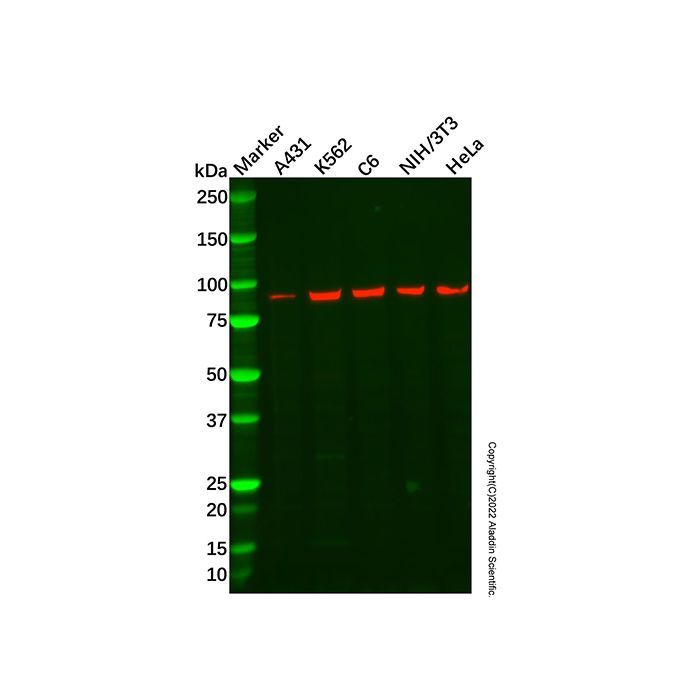 Recombinant FANCB Antibody -    by Aladdin Scientific