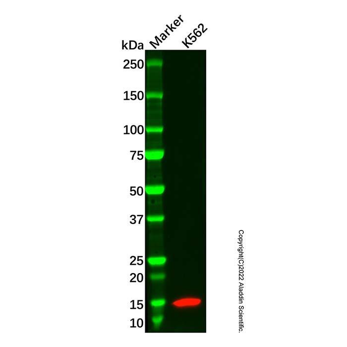 Recombinant fetal hemoglobin Antibody -    by Aladdin Scientific