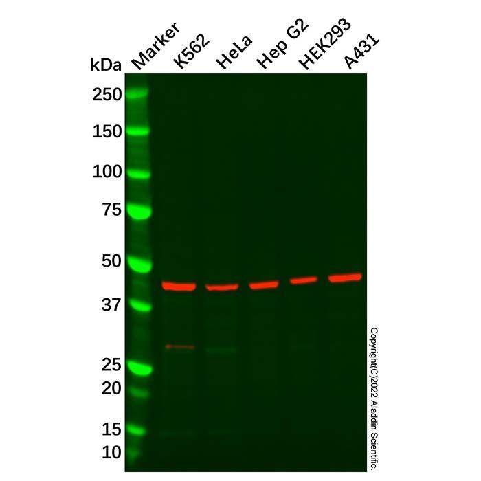 Recombinant FNTB Antibody -    by Aladdin Scientific