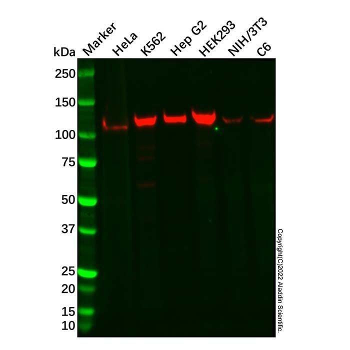 Recombinant GART Antibody -    by Aladdin Scientific