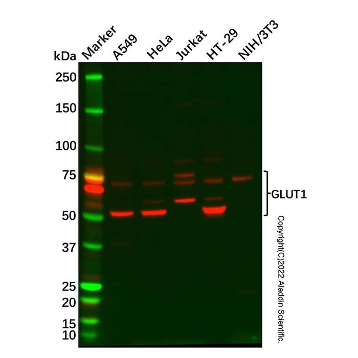 Glucose Transporter GLUT1 Antibody -    by Aladdin Scientific