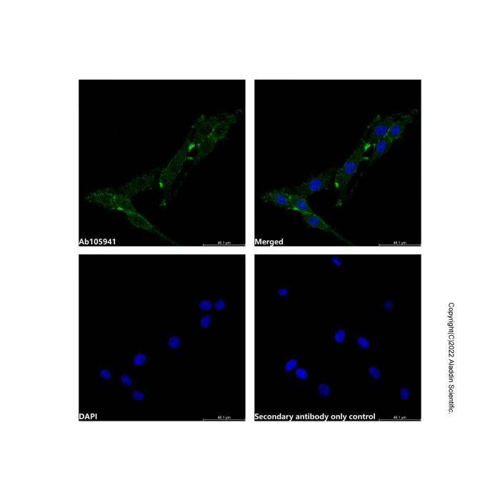 Recombinant GNB2 Antibody -    by Aladdin Scientific