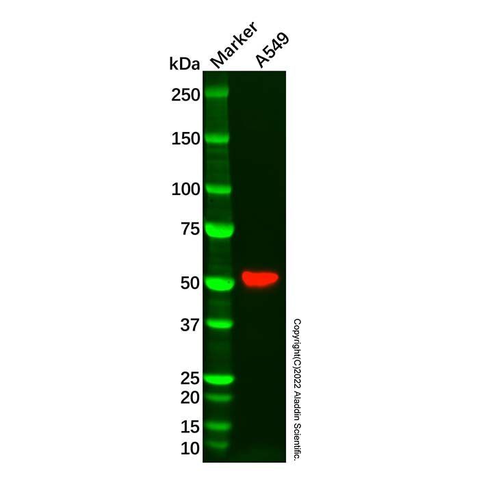 Growth hormone receptor Antibody -    by Aladdin Scientific