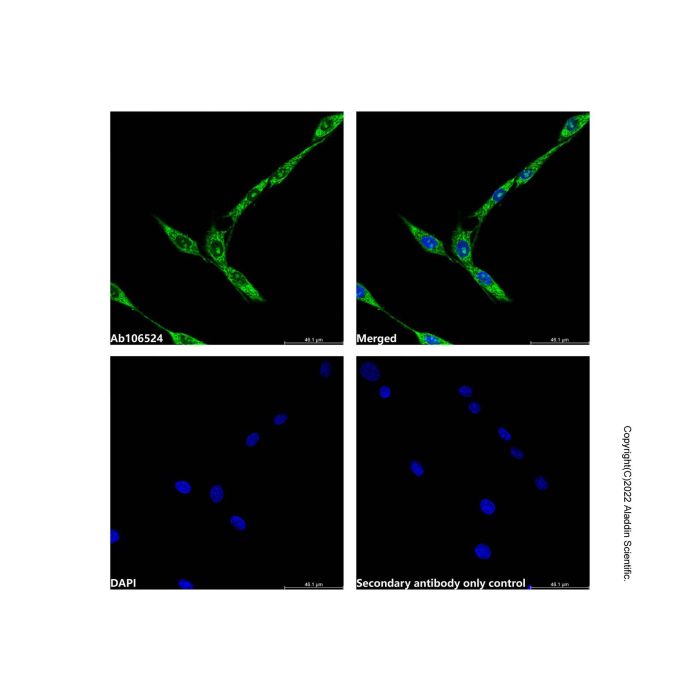 Grp75 Antibody -    by Aladdin Scientific