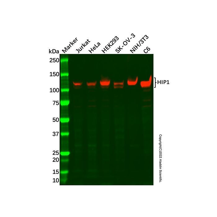 Recombinant HIP1 Antibody -    by Aladdin Scientific