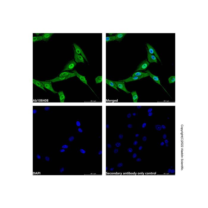 hnRNP A1 Antibody -    by Aladdin Scientific