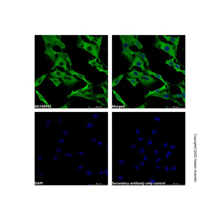 Recombinant Hsp90 beta Antibody -    by Aladdin Scientific