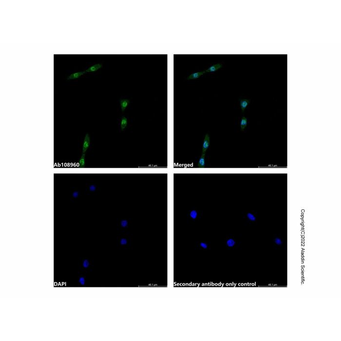 Recombinant HSPA2 Antibody -    by Aladdin Scientific