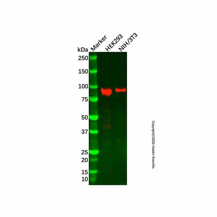 Recombinant IFT88 Antibody -    by Aladdin Scientific