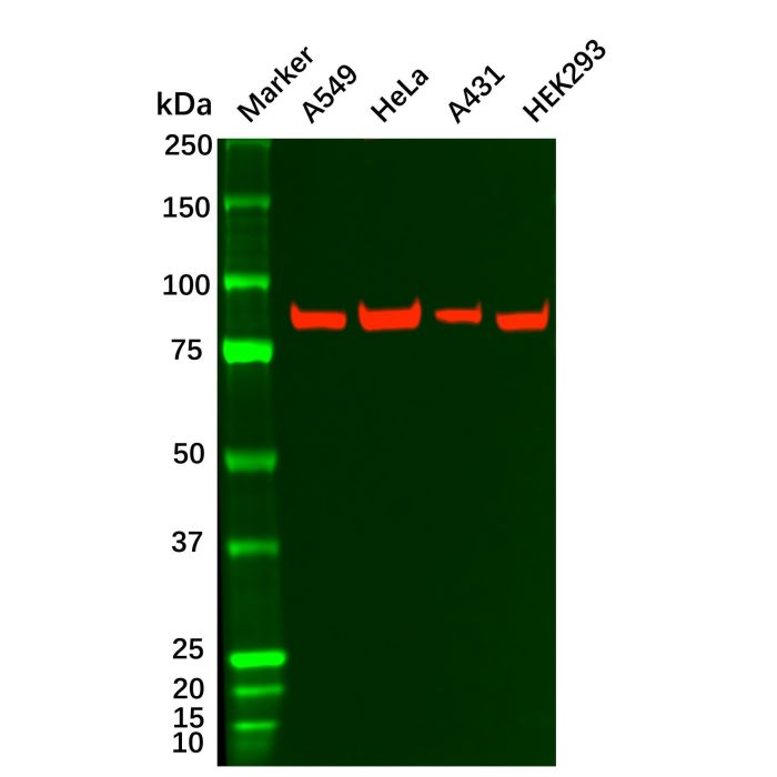 Recombinant IKK beta Antibody - Primary antibody   by Aladdin Scientific