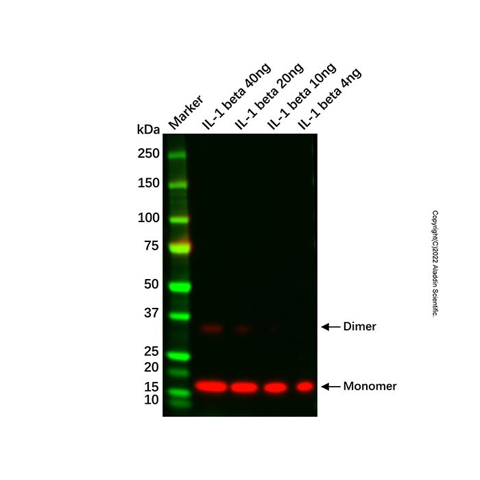 Recombinant  IL-1 beta/IL1B Antibody -    Ab109785 by Aladdin Scientific