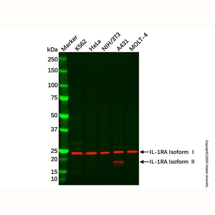 Recombinant IL-1RA Antibody -    by Aladdin Scientific