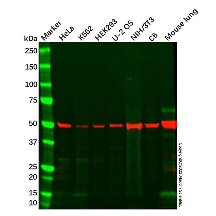 Recombinant Integrin Linked ILK Antibody -    by Aladdin Scientific