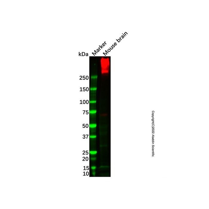 Recombinant IP3 receptor Antibody -    by Aladdin Scientific
