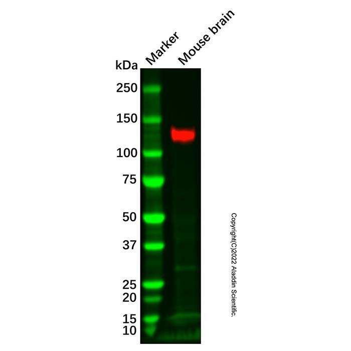 Recombinant KA1 Antibody -    by Aladdin Scientific
