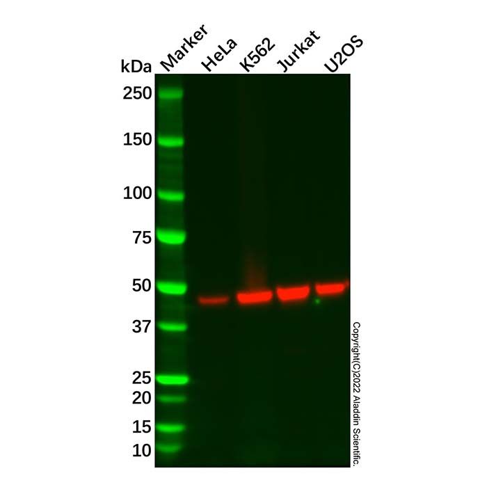 Recombinant KAT1/HAT1 Antibody -    by Aladdin Scientific