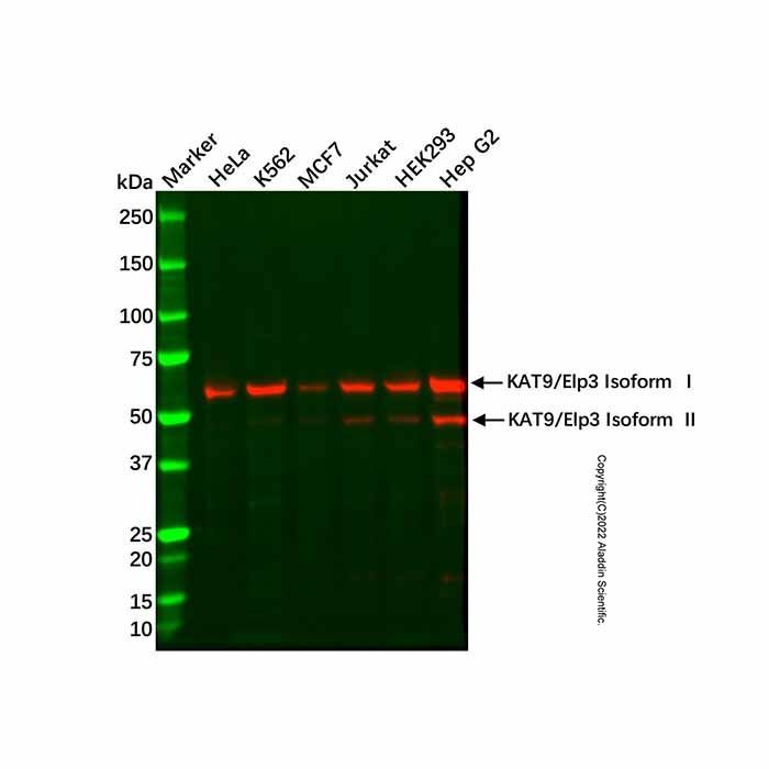 Recombinant KAT9/Elp3 Antibody -    by Aladdin Scientific