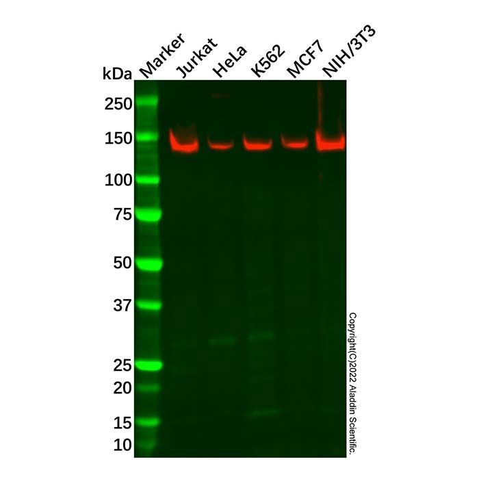 Recombinant KDM2A Antibody -    by Aladdin Scientific