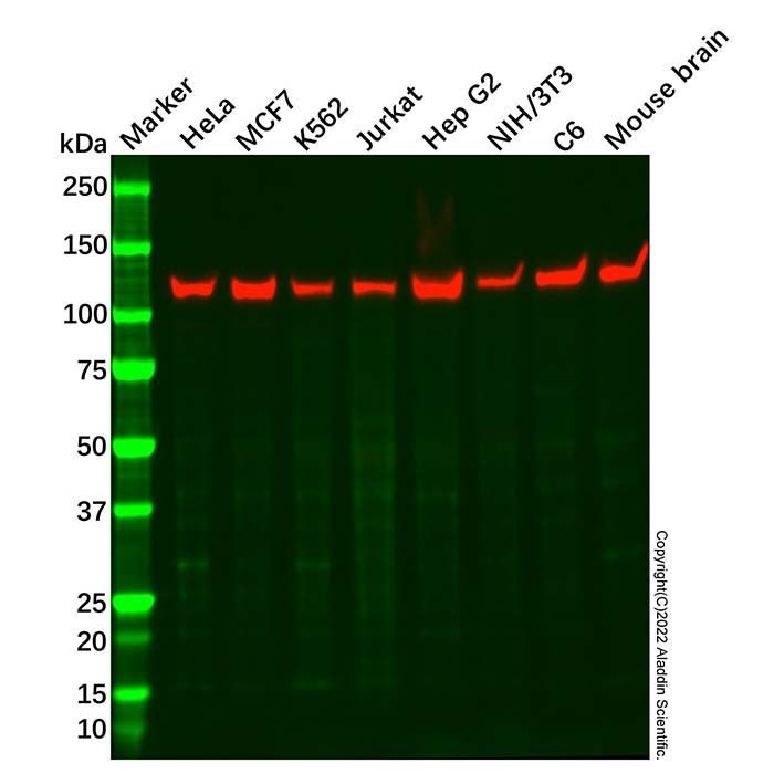 Recombinant KIF5B Antibody -    by Aladdin Scientific