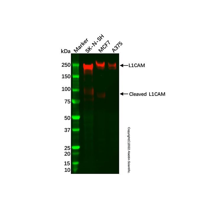 Recombinant L1CAM Antibody -    by Aladdin Scientific