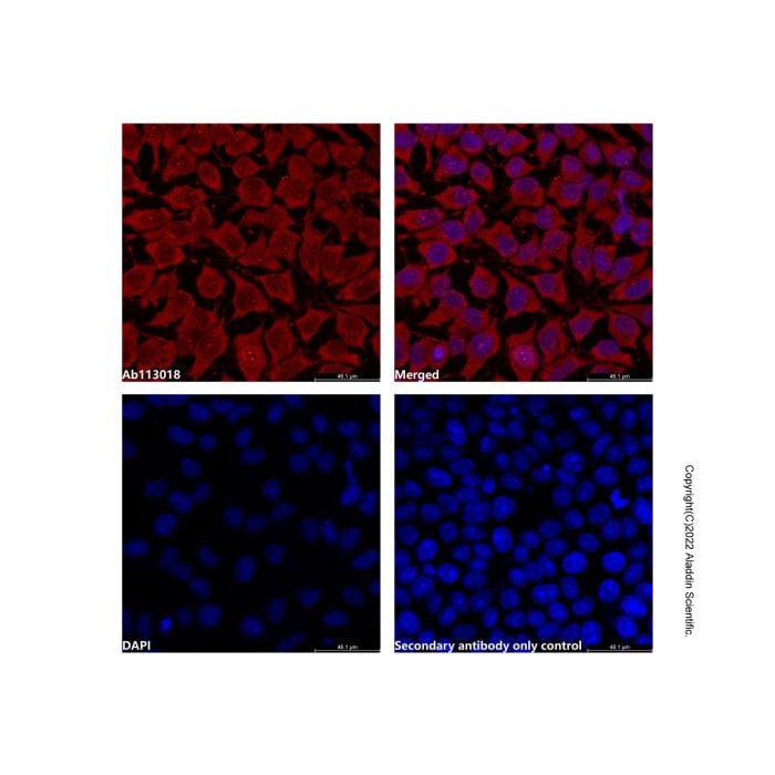 Leukotriene A4 hydrolase/LTA4H Antibody -    by Aladdin Scientific