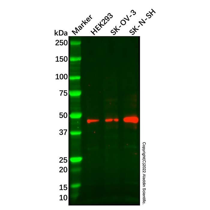 Recombinant LIS1 Antibody -    by Aladdin Scientific