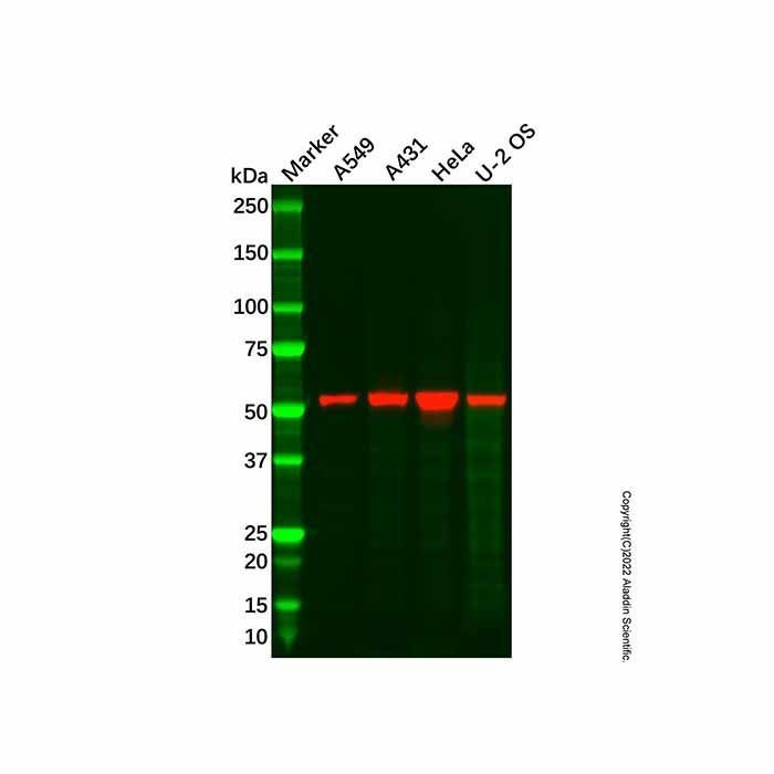 Recombinant LPCAT1 Antibody -    by Aladdin Scientific