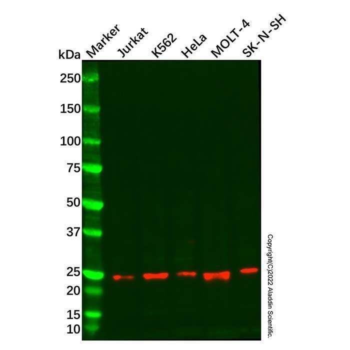 Recombinant Mad2L2/REV7 Antibody -    by Aladdin Scientific