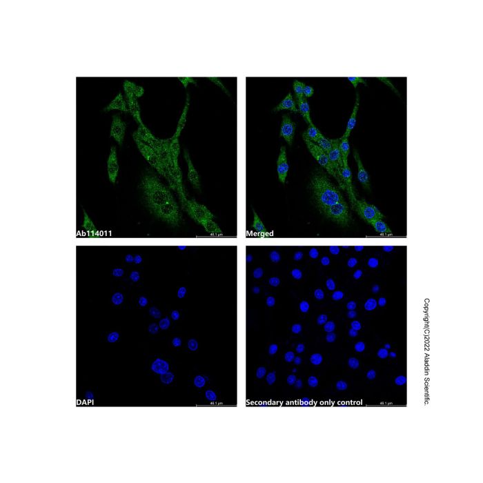 MAGEA1 Antibody -    by Aladdin Scientific