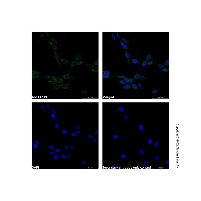 Recombinant MAPK6/ERK3 Antibody -    by Aladdin Scientific