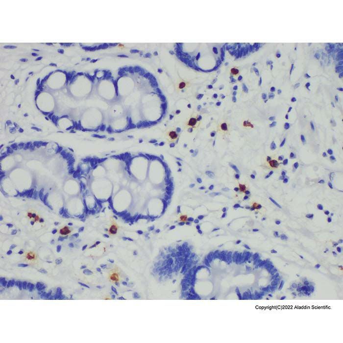 Mast Cell Tryptase Mouse mAb - by Aladdin Scientific