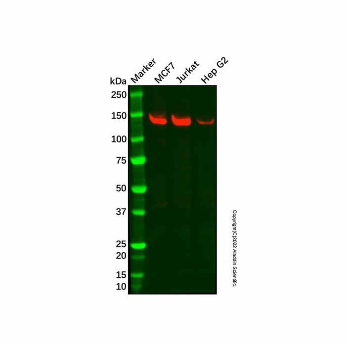 Recombinant MDA5 Antibody -    by Aladdin Scientific
