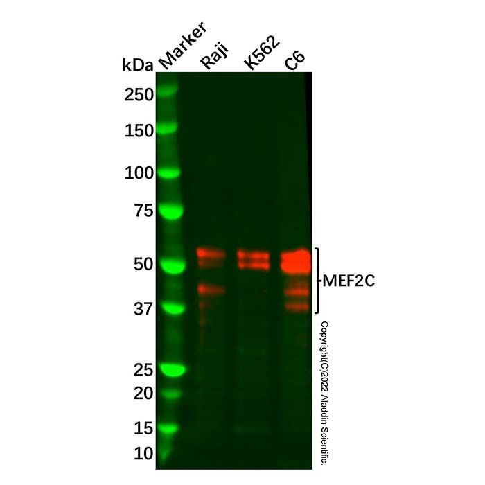 Recombinant MEF2C Antibody -    by Aladdin Scientific