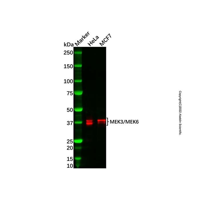 Recombinant MEK3/MEK6 Antibody -    by Aladdin Scientific