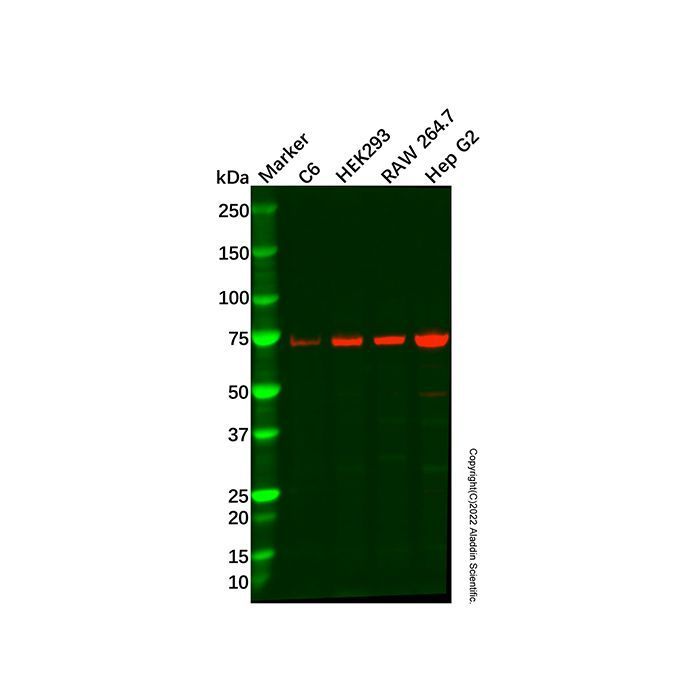 Recombinant METTL3 Antibody -    by Aladdin Scientific