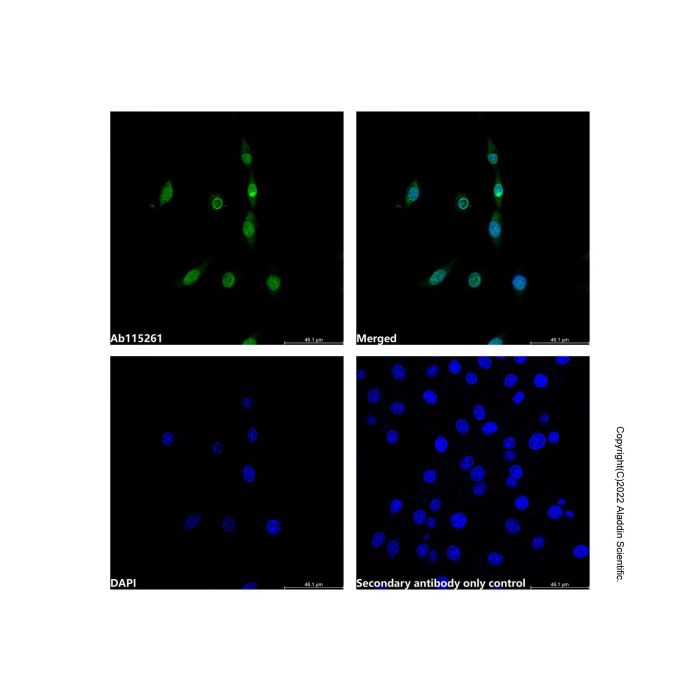 Recombinant mH2A1 Antibody -    by Aladdin Scientific