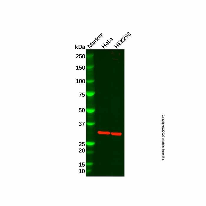 Recombinant MLD Antibody -    by Aladdin Scientific