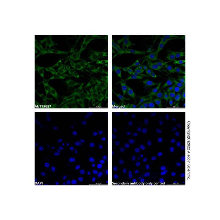 MMP2 Mouse mAb -    by Aladdin Scientific
