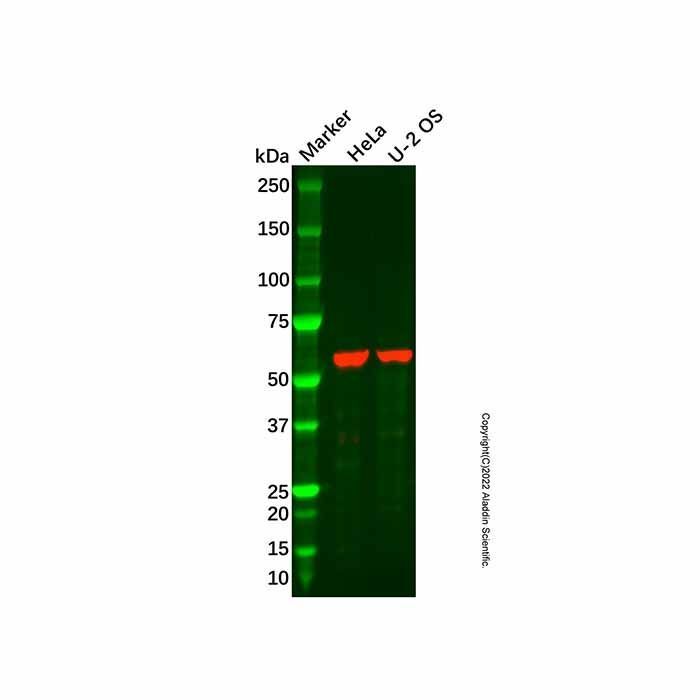 Recombinant Monoamine Oxidase B/MAOB Antibody -    by Aladdin Scientific