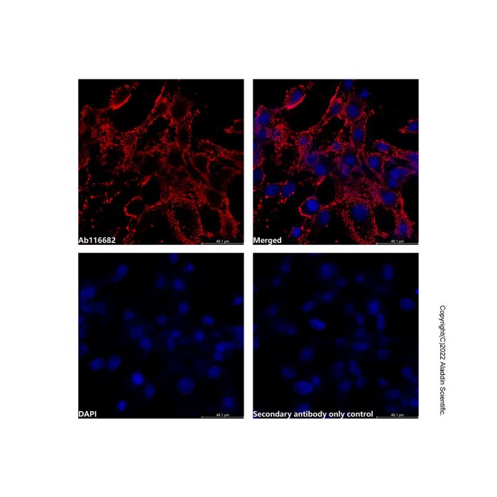 Recombinant Myelin oligodendrocyte glycoprotein Antibody -    by Aladdin Scientific