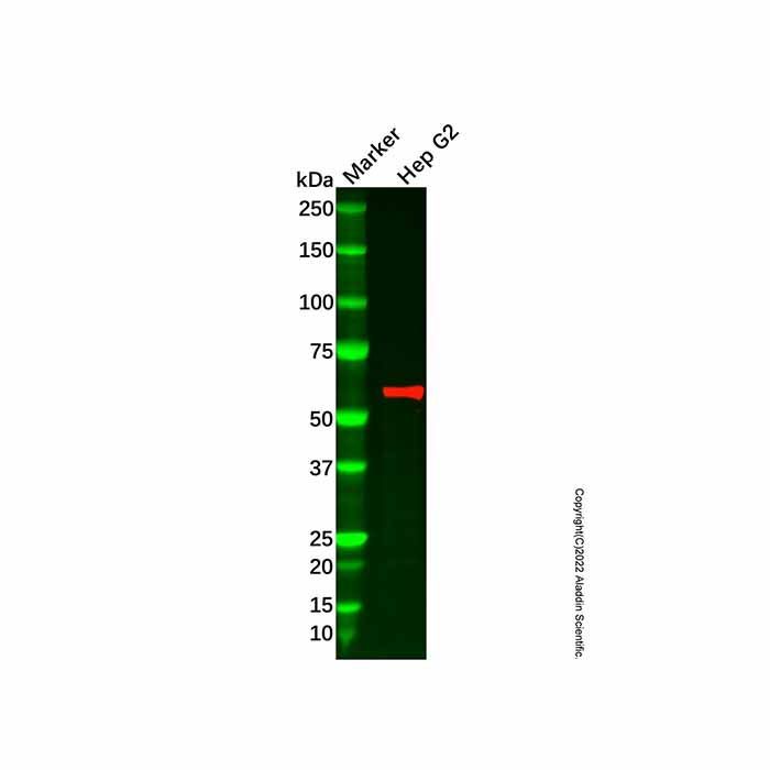 Recombinant NCAPH2 Antibody -    by Aladdin Scientific