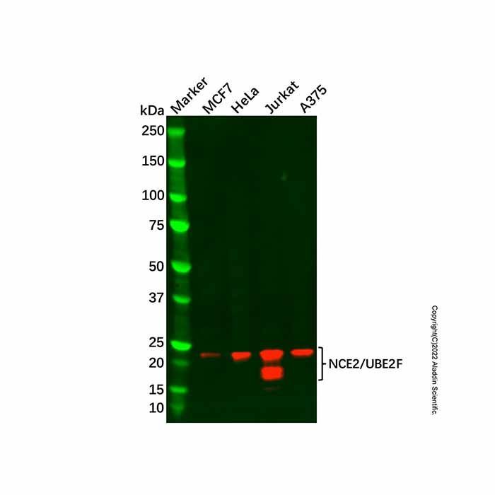 Recombinant NCE2/UBE2F Antibody -    by Aladdin Scientific
