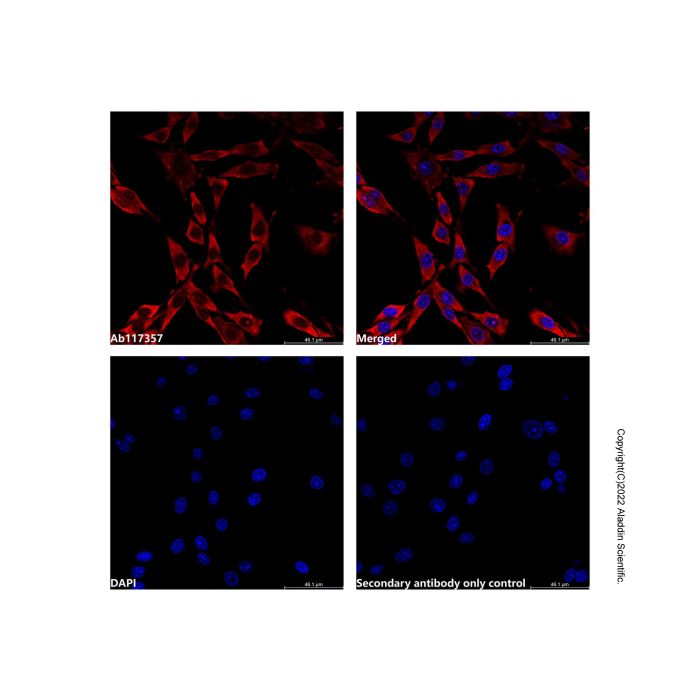 Recombinant NDUFAF5 Antibody -    by Aladdin Scientific