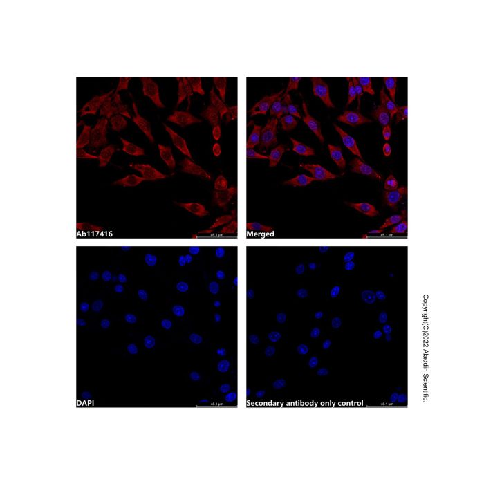 Recombinant NDUFS6 Antibody -    by Aladdin Scientific