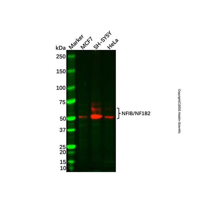 Recombinant NFIB/NF1B2 Antibody -    by Aladdin Scientific