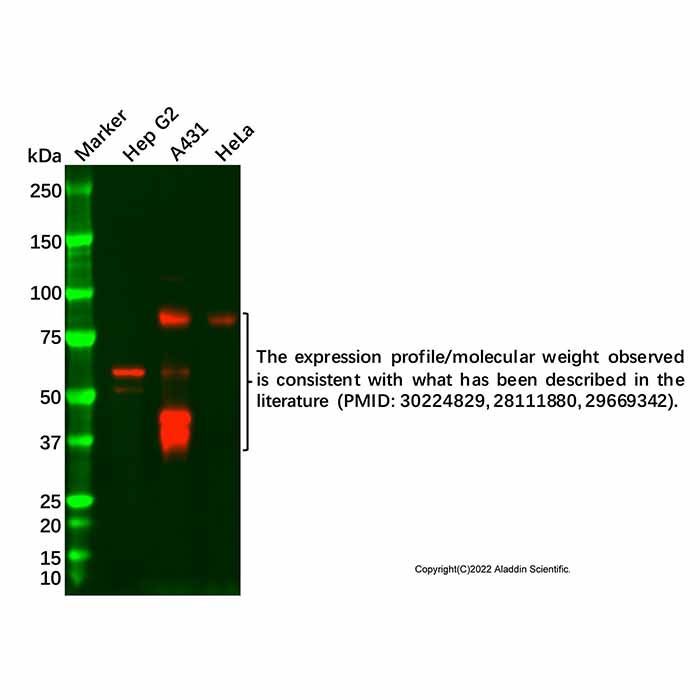 NUR77 Antibody -    by Aladdin Scientific