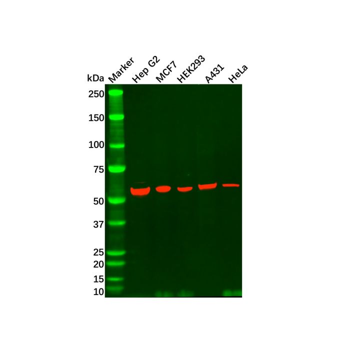 P4HB Antibody -    by Aladdin Scientific