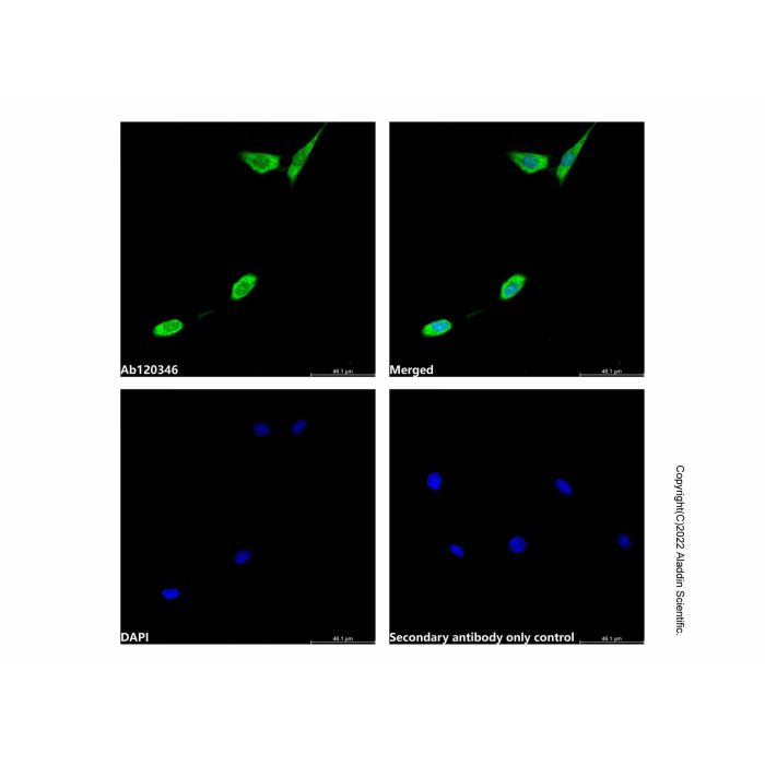 PARK7 Antibody -    by Aladdin Scientific