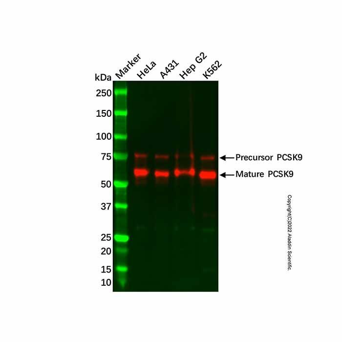 Recombinant PCSK9 Antibody -    by Aladdin Scientific